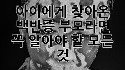 아이에게 찾아온 백반증, 부모라면 꼭 알아야 할 모든 것